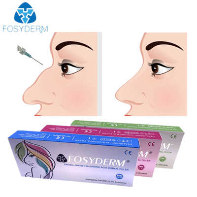 Hyaluronic кисловочная дермальная впрыска 1ml 2ml заполнителя носа для женского использования