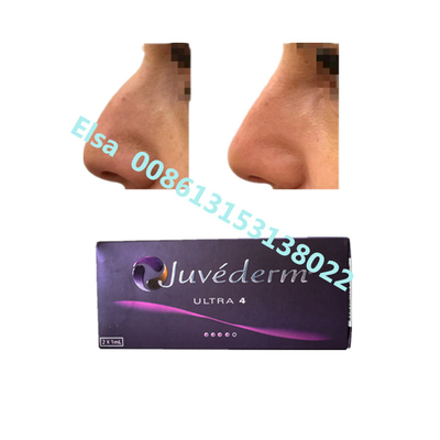 Juvederm Sodium Ultra4 Voluma Dermal Filler для увеличения губ и подбородков