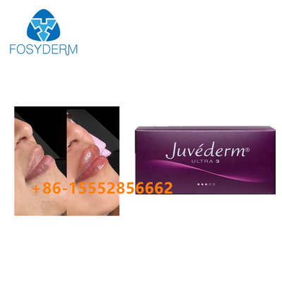 Впрыска Juvederm 2ml заполнителя повышения губы дермальная Hyaluronic кисловочная