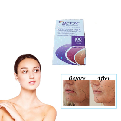 Единицы Allergan Botox 100 Типы Инъекция ботулинического токсина против морщин