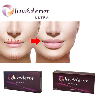 Juvederm Ultra3 Гиалуроновая кислота для губ Гель для кожных инъекций