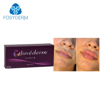 Juvederm Dermal Lip Fillers 2*1ml Гиалуроновая кислота с перекрестным соединением для инъекций