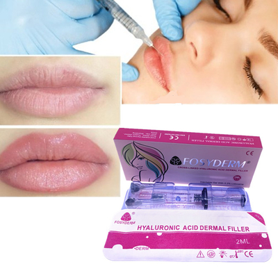 Наполнитель для губ Увеличение полноты губ 2 мл Dermal Filler Fosyderm HA Filler Injection