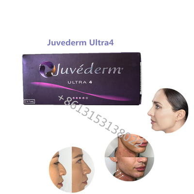 Заполнители Juvederm HA заполнителя Juvederm Ultra4 Allergan наполненности губы дермальные для губ
