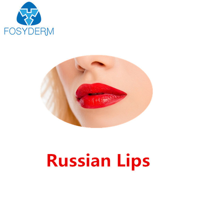 Juvederm ультра 3 Hyaluronic кисловочных губы дермальных заполнителя русских с Lidocaine