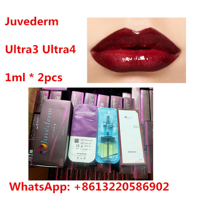 Заполнитель HA губы Juvederm дермальный с Lidocaine Ultra3 Ultra4