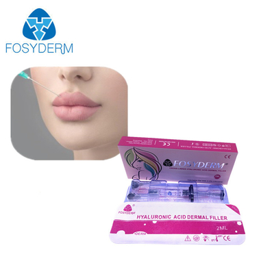 Заполнитель Fosyderm вводимый Hyaluornic кисловочный дермальный с заполнителями стороны носа губы lidociane 2ml