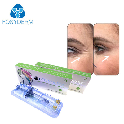 Заполнитель Fosyderm вводимый Hyaluornic кисловочный дермальный с заполнителями стороны носа губы lidociane 2ml