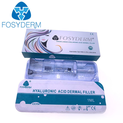 Щека заполнения губы поднимая лицевой заполнитель вводимое Fosyderm 2ml HA дермальный