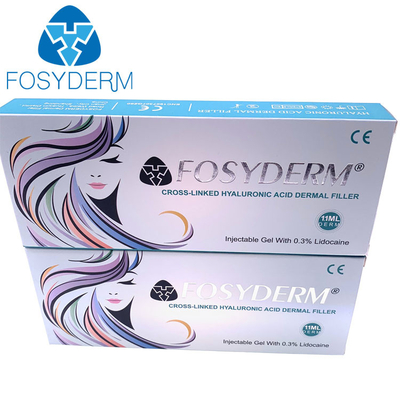 Заполняя заполнители 1ml губы Fosyderm Fosyderm впрыски стороны Hyaluronic кисловочные