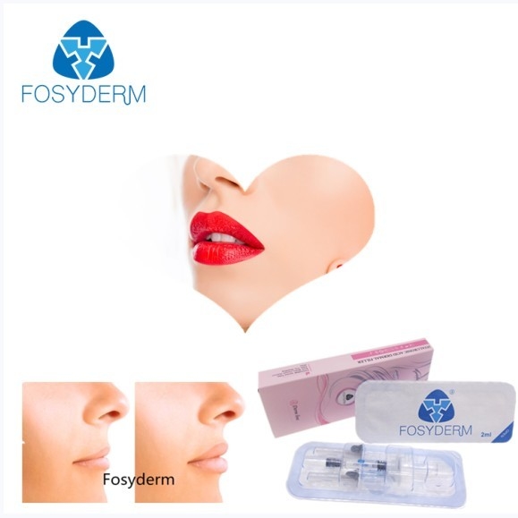 Гел Фосйдерм 2мл пересеките соединенный заполнитель Хялуроник кислоты дермальный для повышения губы