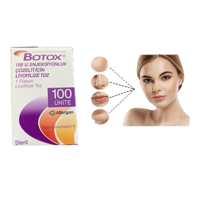 Деятельность удаления морщинки впрыски Botox токсина Allergan 100units Botulinum