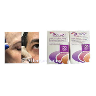 Botulinum впрыска Allergan  токсина для морщинки извлекает