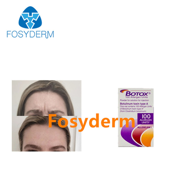 Впрыски токсина Allergan Botulinum извлекают морщинки 100 блоков
