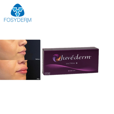 Повышение губы заполнителей Juvederm 2ml Hyaluronic кисловочное