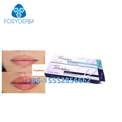 Повышение губы морщинок дермального заполнителя  1ml Hyaluronic кисловочное анти-