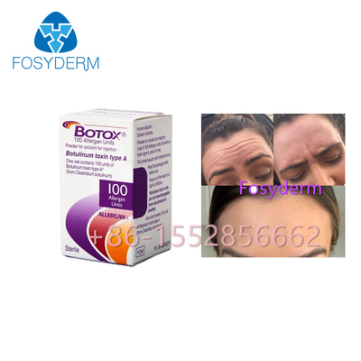 Allergan Botox 100 морщинок Botulinum токсина блоков анти- печатает впрыску
