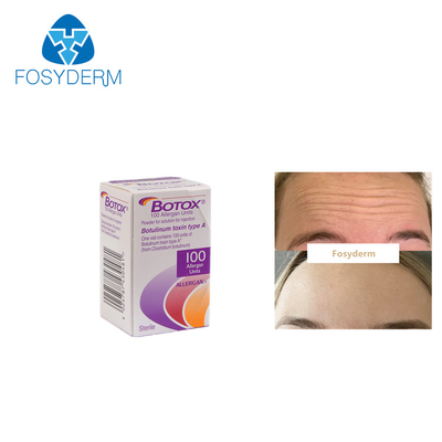 Allergan  100 морщинок Botulinum токсина блоков анти- печатает впрыску