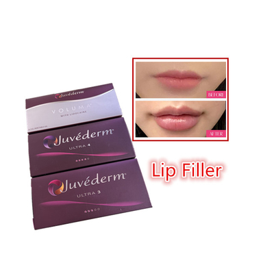 2 мл гиалуроновой кислоты с перекрестным связыванием с кожным наполнителем Juvederm Lip Filler Injections