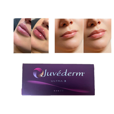 Juvederm Гиалуроновая кислота Dermal Filler Антиморфные личные липовые фильтры