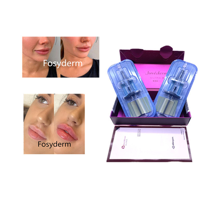 Juvederm Гиалуроновая кислота Dermal Filler Anti Aging 2*1ml Наполнитель для лица
