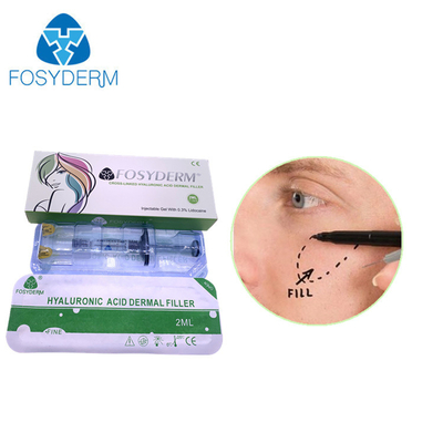 Fosyderm Deep 2ml Dermal Filler для омоложения лица HA Filler