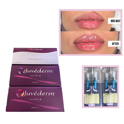 Juvederm Voluma Ultra3 Ultra4 HA Гелевые наполнители 2 мл гиалуроновой кислоты