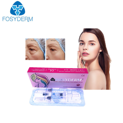 OEM Гиалуроновая кислота Dermal наполнитель для толстой и сияющей кожи