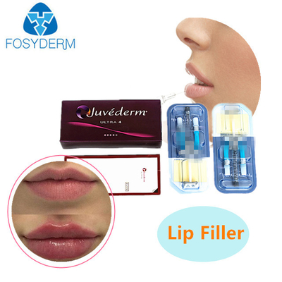 2 мл гиалуроновой кислоты для наполнения кожи JUVEDERM Инъекционный гель для наполнения морщин