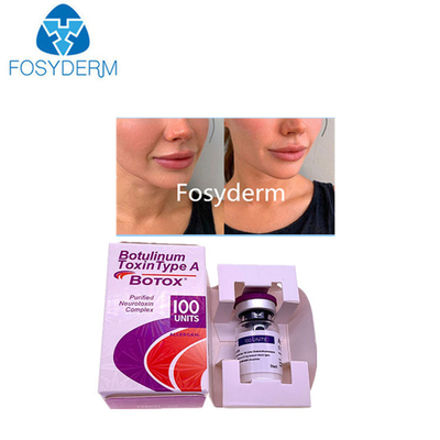 Тип А 100 единиц Аллерген ботулинический токсин Dermal Filler Гиалуроновая кислота