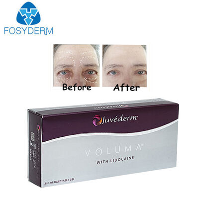 Juvederm Hyaluronic Acid Dermal Filler Voluma Face Lifting 2*1ml