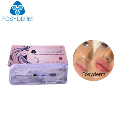 Крест Fosyderm 100% чистый соединил кислоту впрыски 1ml Hyaluronic для заполнителя губы