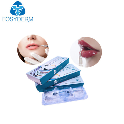 hyaluronic кисловочная впрыска повышения губы Derm заполнителей губы 1ml для женщин