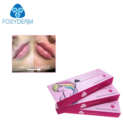 Fosyderm 1 мл гиалуроновой кислоты для увеличения размеров губ