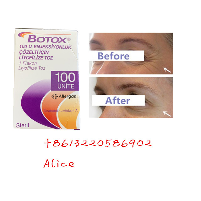 Анти- старея токсин Allergan анти- морщинки Botulinum печатает порошок