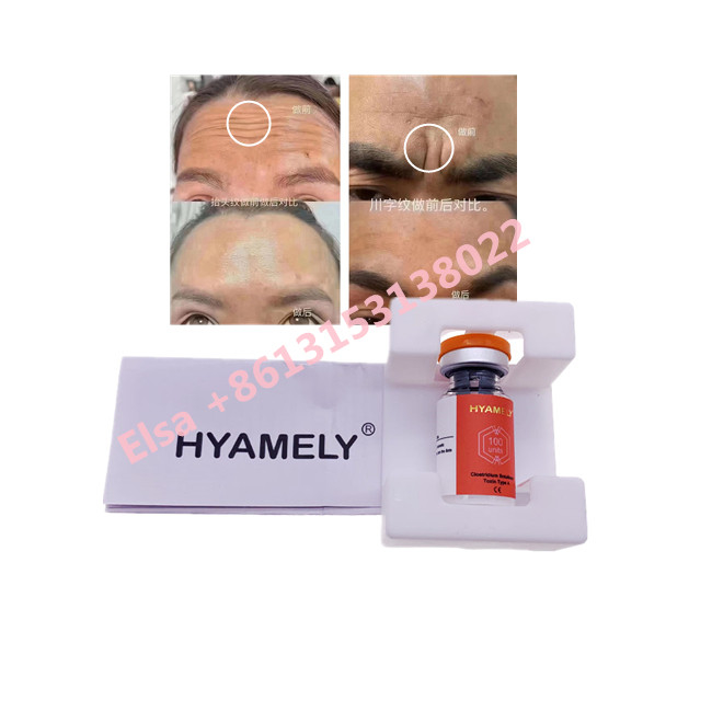 Токсин Hyamely  Botulinum напечатать корейскую косметику  100u