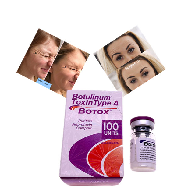 Тип токсина Allergan Botulinum кислота дермального заполнителя блока Botox 100 Hyaluronic