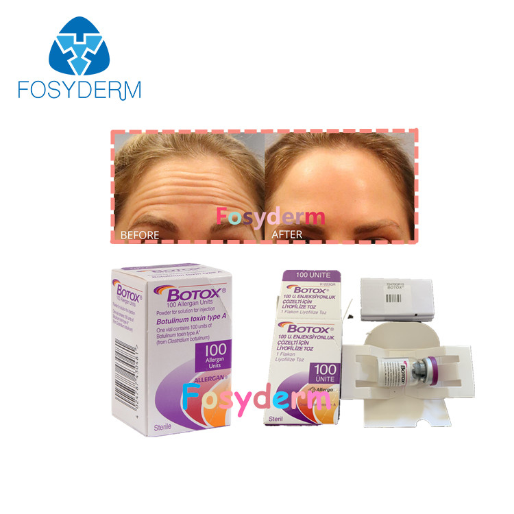 Botulinum анти- впрыска TypeA  Allergan токсина морщинки 100Units