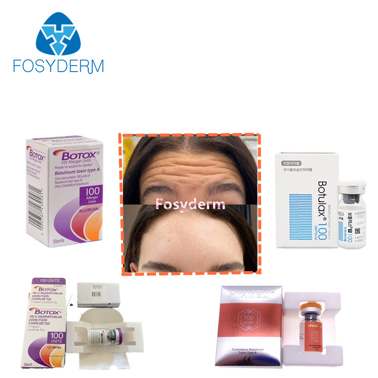 впрыски токсина 100units TypeA морщинки  Allergan Botulinum анти-