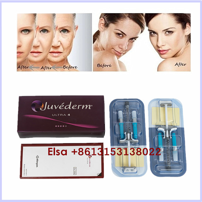 Астетическая впрыска геля заполнителя Juvederm Ultra3 Ultra4 Voluma продуктов Hyaluronic кисловочная дермальная