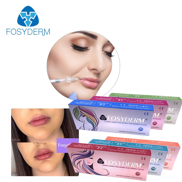 Поставка Dermal Fillers Гиалуроновая кислота гель Dermal Filler Injection