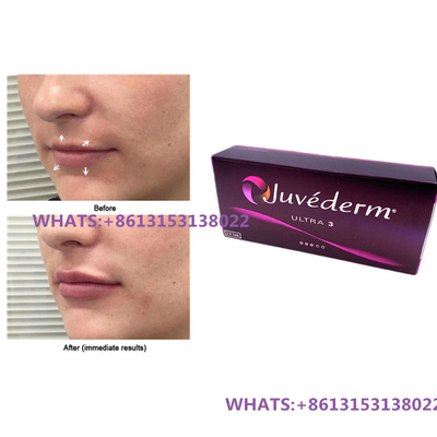 Juvederm Dermal Filler For Lips Juvederm Ultra3 Ultra4 Fillers Предварительно заполненный шприц