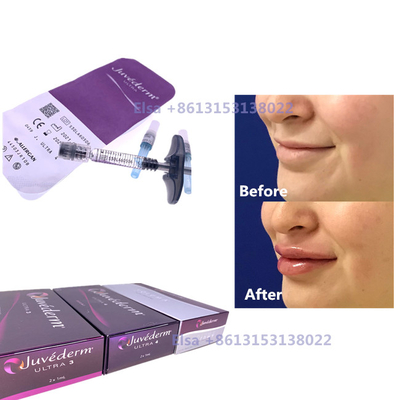 2×1 мл Инъекционное дермальное наполнитель Juvederm Syringe Ultra3