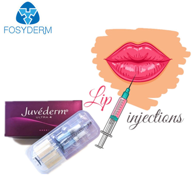 Заполнитель ультра 3 Juvederm Hyaluronic кисловочный дермальный для губ стороны