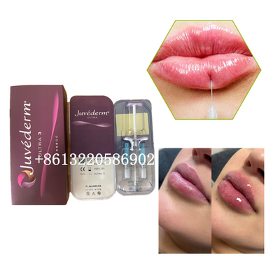 Дермальное впрыски 2ml заполнителя губы Ultra3 Juvederm Hyaluronic кисловочное