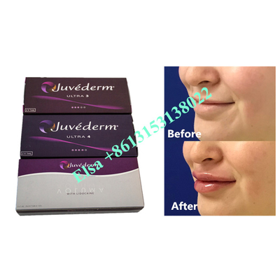 Инъекция дермального наполнителя Voluma Hyaluronic Acid Fosyderm 24 мг / мл