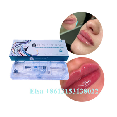 Hyaluronic кисловочный Ce анти- старея 1ml 2ml 5ml заполнителя губы Juvederm впрыски геля