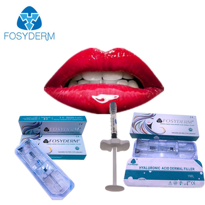 Впрыска Fosyderm 1ml Derm заполнителя Ha губ более пухлая