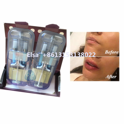 Продукт красоты Juvederm Voluma Гиалуроновая кислота