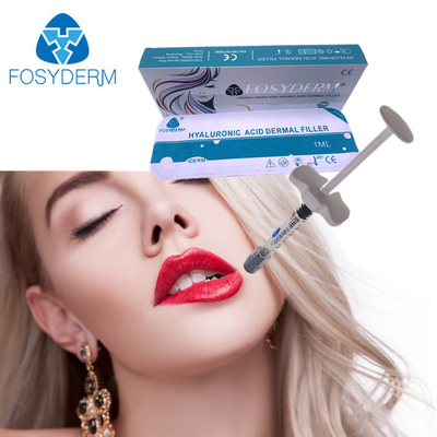 Губ заполнителя Fosyderm 1ml Derm Hyaluronic кисловочная впрыска дермальных более пухлая